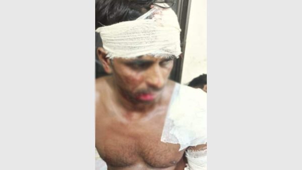 মধুপুরে ছুরিকাঘাতে গুরুতর আহত জহুর আলীকে হাসপাতালে নেওয়া হচ্ছে — ২৪ জুলাই ২০২৫.