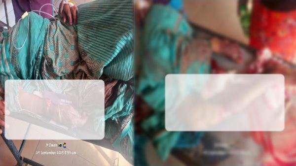ঝিনাইগাতীতে জমি নিয়ে বিরোধে ছেলের কুঠারাঘাতে গুরুতর আহত মা, আইসিইউতে চিকিৎসাধীন।