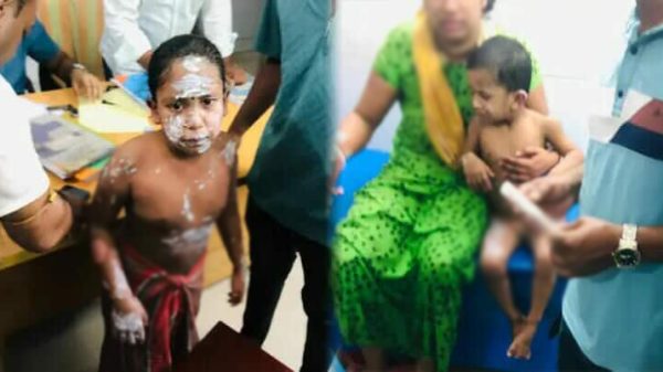 নোয়াখালীর কোম্পানীগঞ্জে গ্যাস বিস্ফোরণে দগ্ধ পরিবারের সদস্যদের উদ্ধার